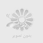 كاشت مو زنان
